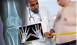 What Type Of Doctor Do You See For Rheumatoid Arthritis