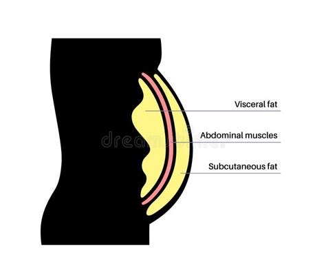 Visceral Fat Diagram Stock Vector Illustration Of Skin 282903910