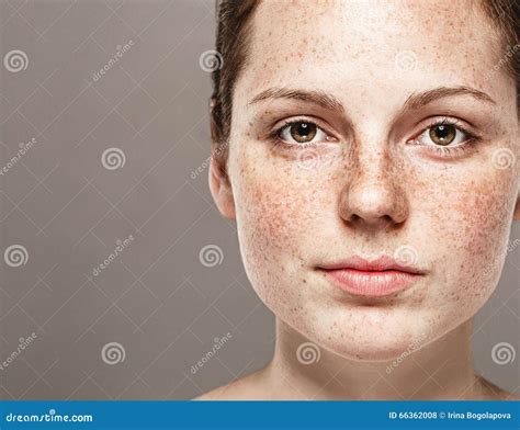 Retrato Hermoso Joven De La Cara De La Mujer De Las Pecas Con La Piel