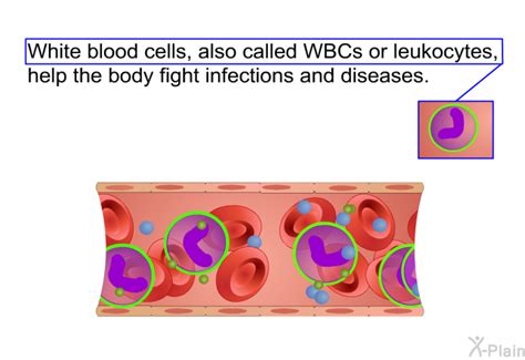 Acute Lymphocytic Leukemia All