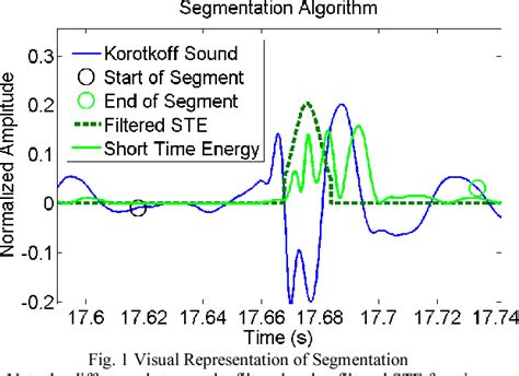 Figure 1 From Acoustic Detection Of Korotkoff Sounds Using Non Linear