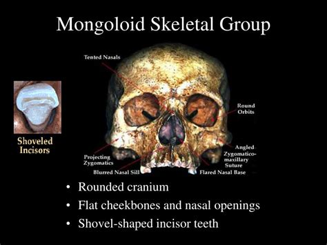 Ppt Identification Of Human Remains Powerpoint Presentation Free Download Id1487312