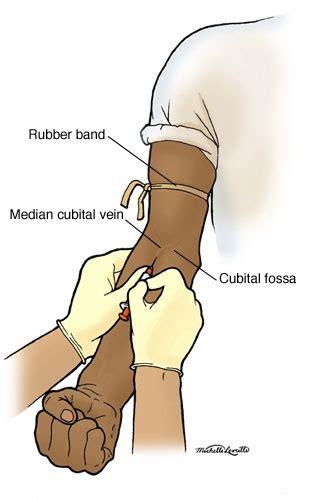 Various formats from 240p to 720p hd (or even 1080p). Anatomy Atlases: Anatomy of First Aid: A Case Study ...