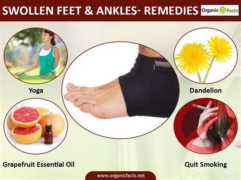 15 Best Home Remedies For Swollen Feet And Ankles With Images