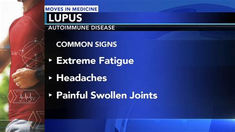 Moves In Medicine What Is Lupus How To Treat It And Advances In