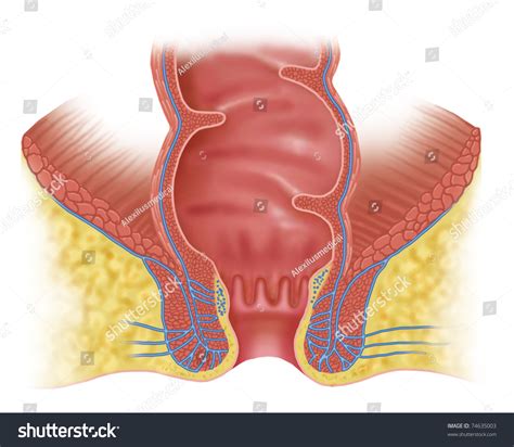 Perirectal Images Stock Photos Vectors Shutterstock