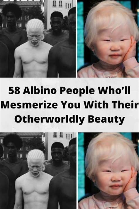 Albino People Wholl Mesmerize You With Their Otherworldly Beauty Albino Celebrity