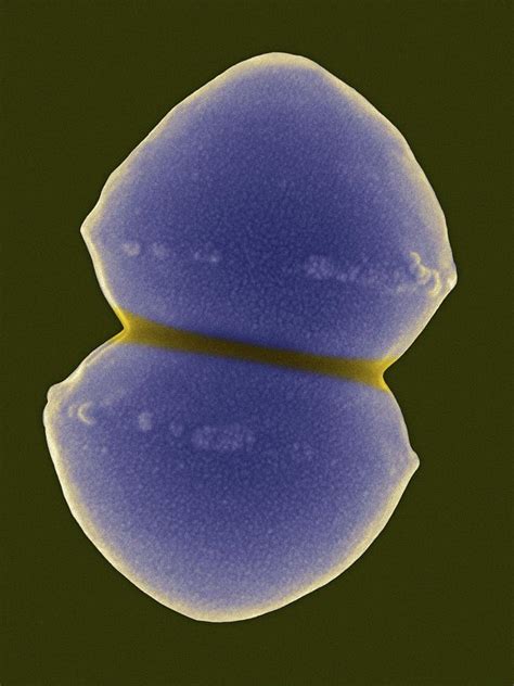 Enterococcus Faecium Photograph By Dennis Kunkel Microscopyscience