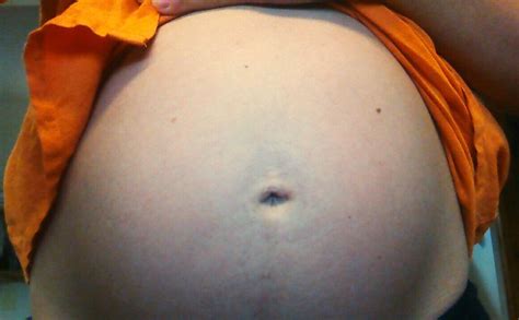 Part 1 Hoping To Avoid Pregnancy Stretch Marks The Pregnancy