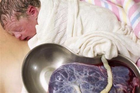 The Incredible Photo Of Delayed Cord Clamping After Birth Netmums