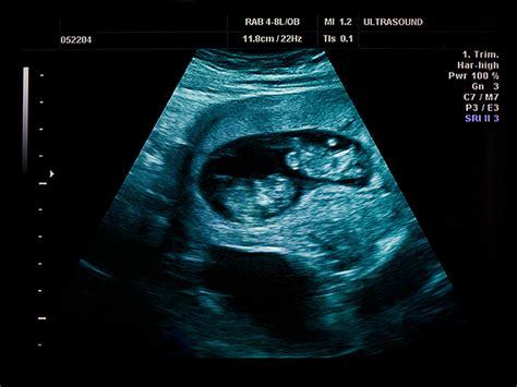 14 Weeks Pregnant Fetal Development Babycenter Canada