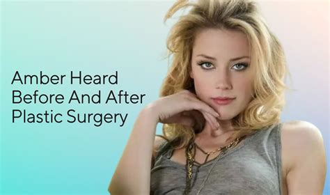 Amber Heard Before And After Plastic Surgery Who Confirmed It How