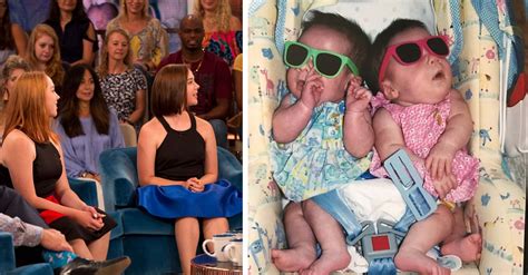 Conjoined Twins That Were Separated At 7 Months Are Now 17