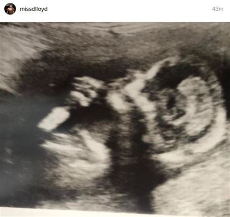 Danielle Lloyd Shares First Baby Scan Photo As She Puts Drama With Ex