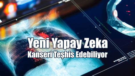 Yeni Yapay Zeka Kanseri Teşhis Edebiliyor Kıbrıslı Gazetesi