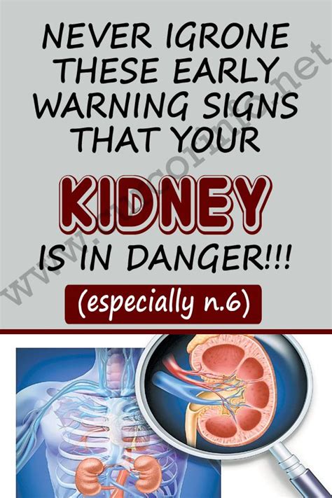 Where Is Kidney Pain Located Cares Healthy