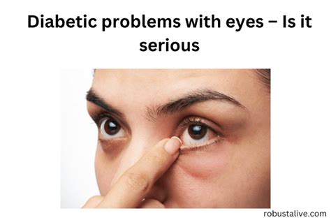 Diabetic Problems With Eyes Is It Serious Robustalive