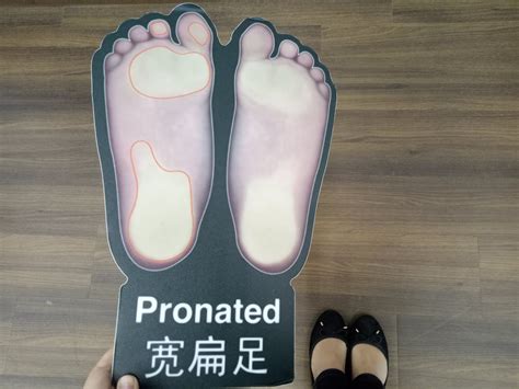 Sunfeet Jenis Tapak Kaki Punca Sakit Kaki Badan Dan Pinggang