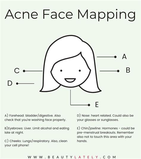Acne Face Maps The Reasons Behind Your Breakouts Face Acne Face