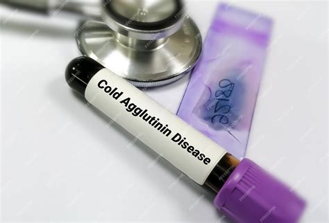 Premium Photo Blood Sample Tube For Cold Agglutinin Disease Cad