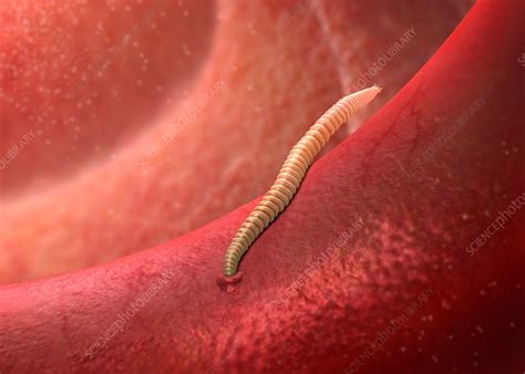 Hookworm In The Intestine Illustration Stock Image C0342679