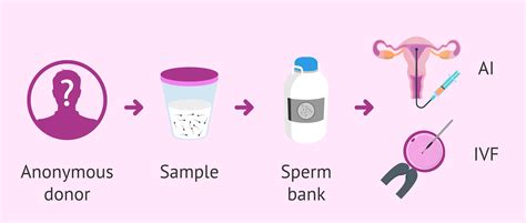 sperm donation procedure