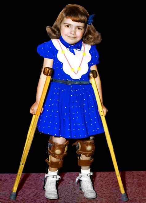 Pin By Dianne Dych On Polio 3 Leg Braces Black Thigh High Fashion
