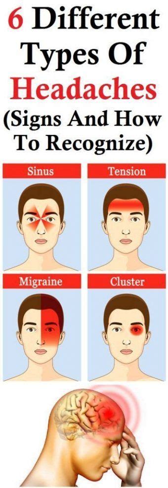 6 Different Types Of Headaches Signs And How To Recognize Headache