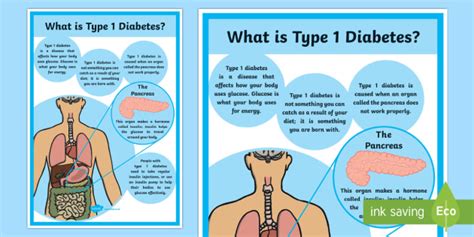 Cfe Type 1 Diabetes Poster 2xa4 Cfe Type 1 Diabetes Poster