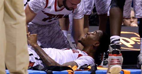 The Latest On Kevin Wares Leg Injury Cbs Los Angeles
