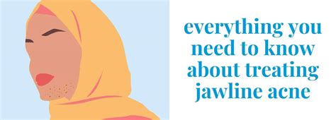 Jawline Acne Causes Prevention And Tips For Quick Relief
