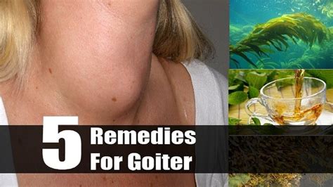5 Useful Home Remedies For Goiter Goiter Is A Disease That Affects