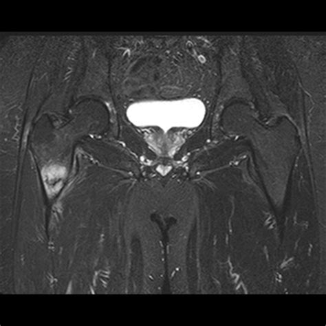 • freie, anatomisch adaptierbare schichtwahl • weichteilauflösung • lymphknotenstaging relative ki, insbesondere frühschwangerschaft kontraindikation: Bildergalerie | MR Institut Bludenz