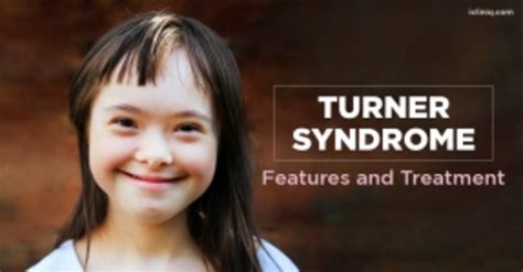 Health Articles In Turner Syndrome