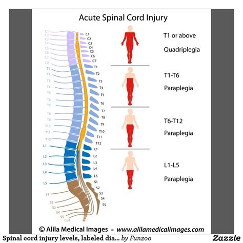 Spinal Cord Injury Anatomy Hot Sex Picture
