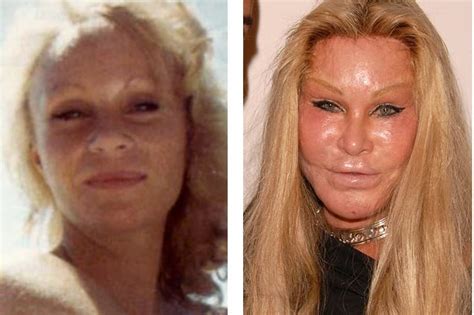Pictures Of Jocelyn Wildenstein Before She Got Plastic Surgery