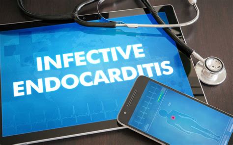 Infective Endocarditis And How Oral Hygiene Protects Us Los Angeles