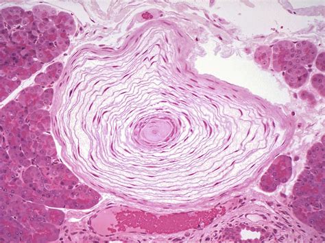 Receptor, has been of interest to many. meissner corpuscle - Google Search in 2020 | Abstract ...