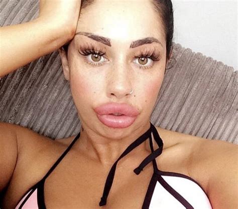 This Woman Wants To Take Her Huge Lips And Make Them Even Bigger Pics