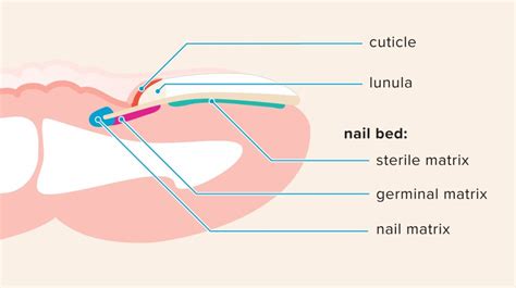 Beginning in the nail matrix, subungual melanoma is one of the types of melanoma affecting nails. Nail Matrix: Anatomy, Function, Injuries, and Disorders