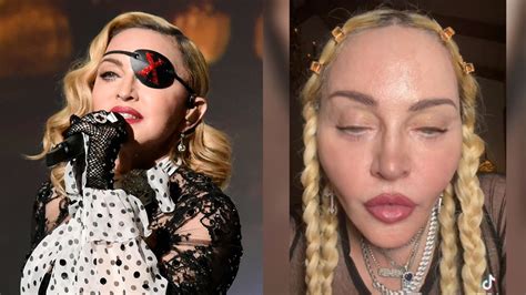 Madonna Aparece Com O Rosto Inchado E Levanta Rumores De Novo Botox My Xxx Hot Girl