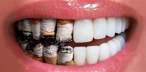 what does smoking do to your teeth ph
