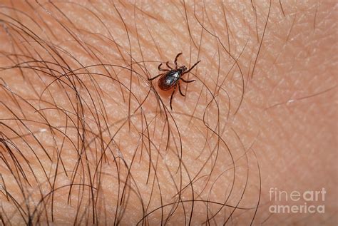 Blacklegged Tick 1 Photograph By John Kaprielian Fine Art America