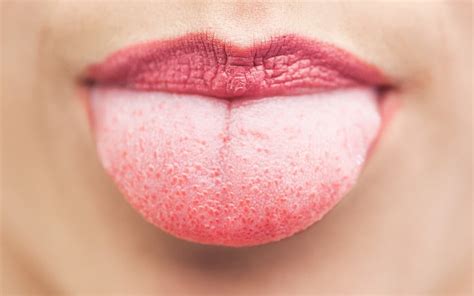 Keeping Your Tongue Healthy Watts Blog