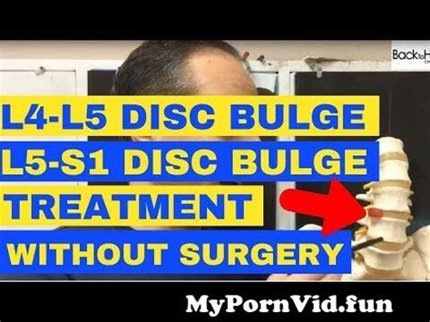 L L And L S Discs Bulge Treatment Without Surgery Chiropractor In Vaughan Dr Walter