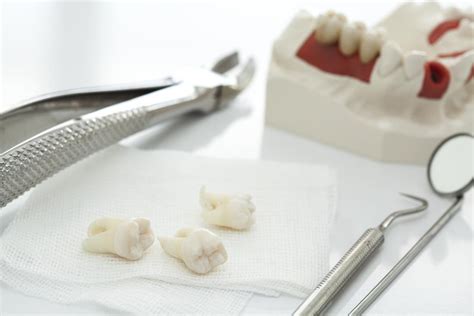How Long Does It Take To Heal From Wisdom Teeth Removal Boston