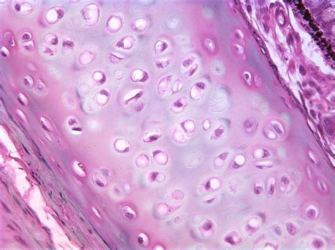 Hyaline Cartilage Medical Pictures Info Health Definitions Photos