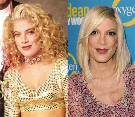 Tori Spelling Before And After Plastic Surgery Celebrity Plastic Surgery Online