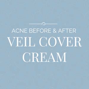 Acne Before And After Veil Cover Cream Veil Cover Cream Blogveil