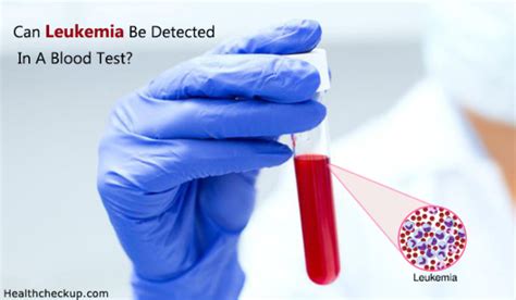 Can Leukemia Be Detected In A Blood Test Health Checkup